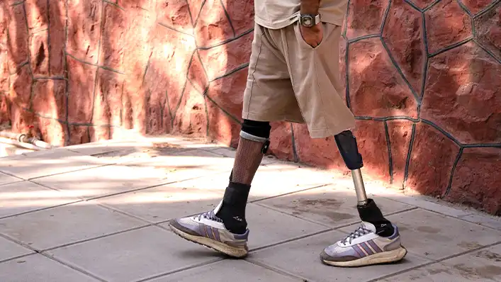 انواع پای مصنوعی