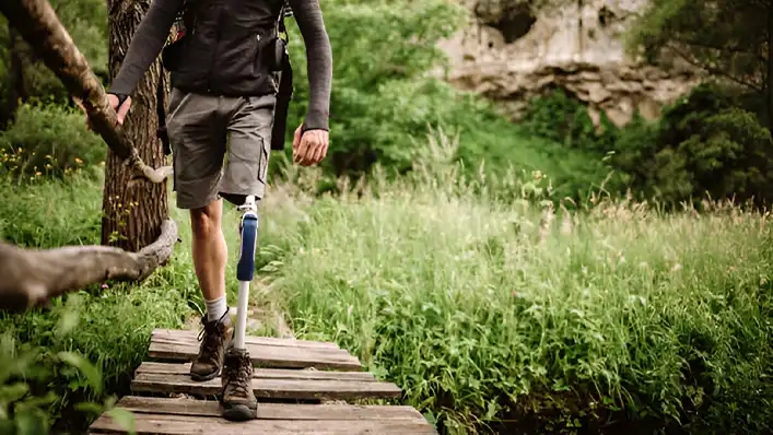 هزینه پای مصنوعی