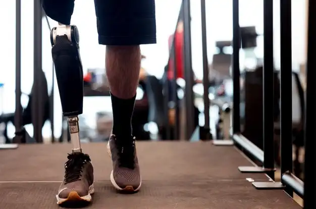 Osseointegration