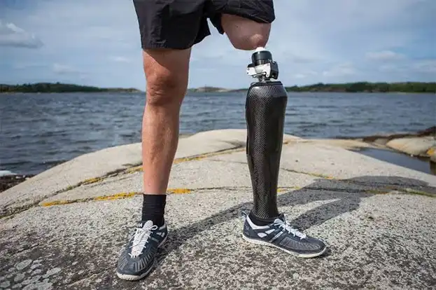 Osseointegration چیست؟